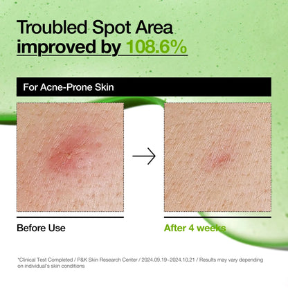 Anua Azelaic Acid 10+ Hyaluronic Serum